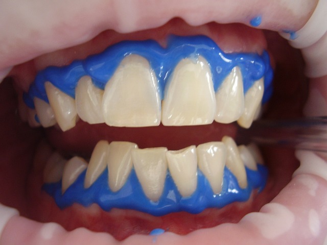 Использование лазера в лечении зубов