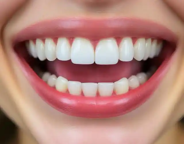 Виды коронок на передние зубы