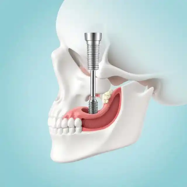 Стоматологическая процедура