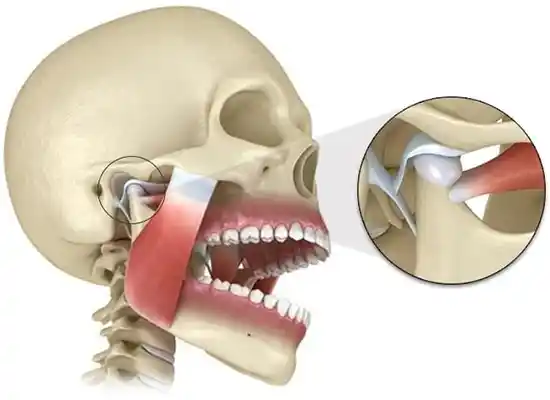 Гнатолог проводит диагностику ВНЧС